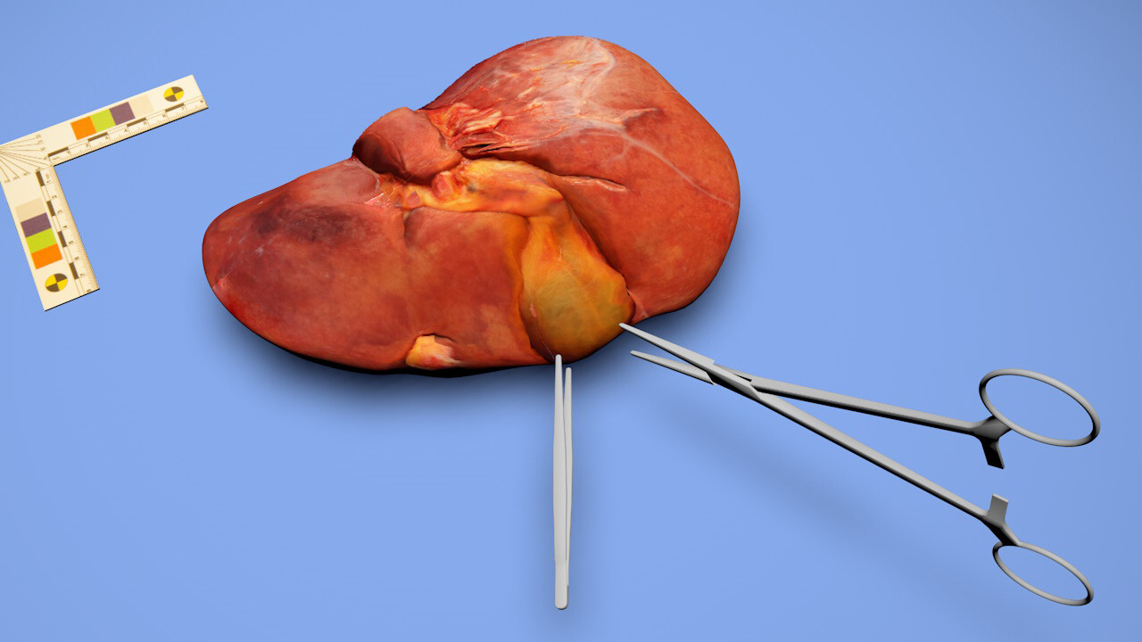 3D-Rendering einer menschlichen Leber; anhand der Modell-Inszenierung wird der Frage nachgegangen: Welche gestalterischen und didaktisch-interaktiven Aspekte müssen bei der Vermittlung einer virtuellen Schnittführung des Organs berücksichtigt werden?